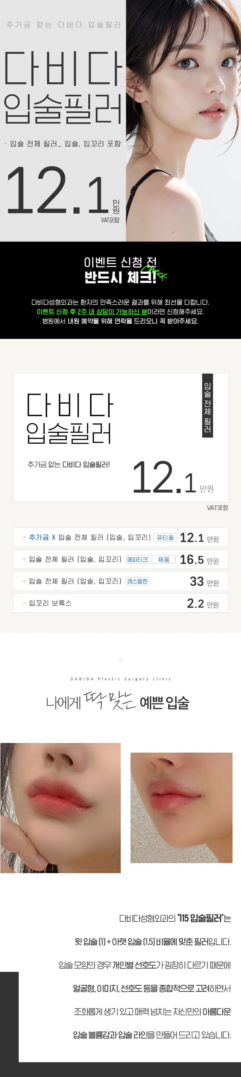 다비다성형외과의원 황금 비율 115 입술필러 이벤트, 시술 상세 이미지