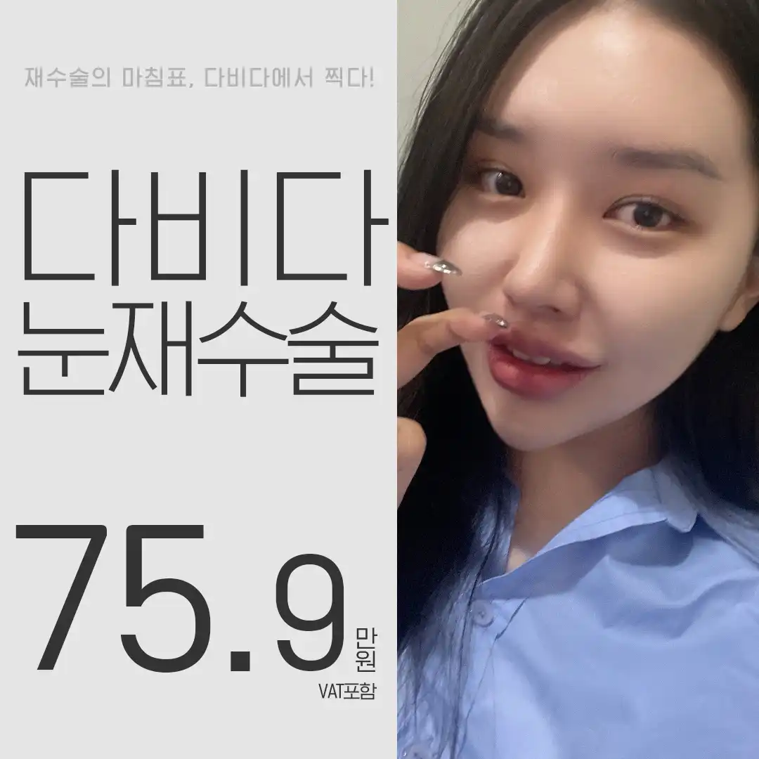 재수술 마침표 쌍꺼풀재수술