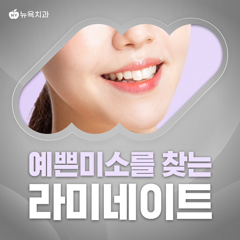 예쁜 미소를 찾는 라미네이트 이벤트 썸네일 이미지