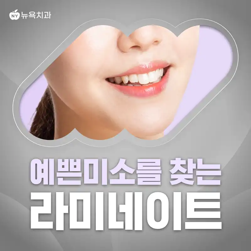 예쁜 미소를 찾는 라미네이트