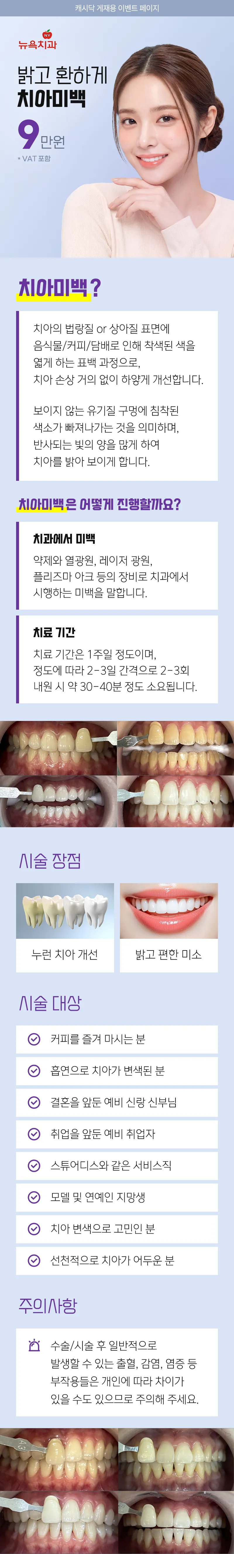 뉴욕치과의원 밝고 환하게 치아미백 이벤트, 시술 상세 이미지