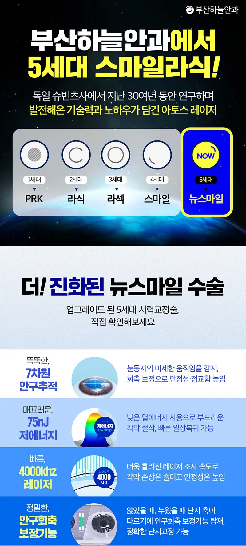 부산하늘안과 5세대 뉴스마일라식 특별가 안내 이벤트, 시술 상세 이미지