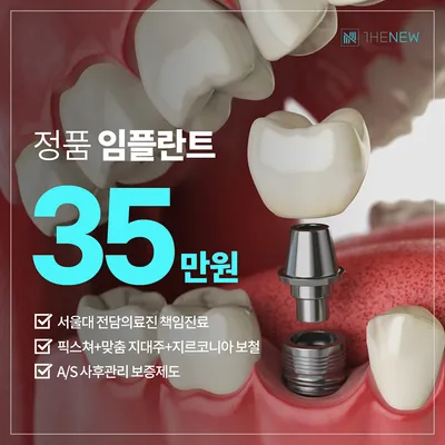 전원 서울대 출신 임플란트 35만원 이벤트 썸네일 이미지