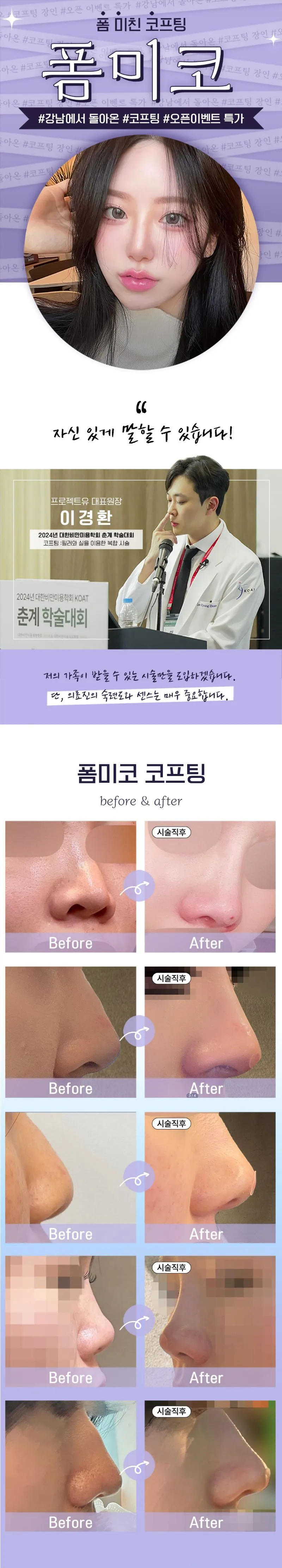 프로젝트유의원 💋시그니처_폼미코💄대표원장직접시술 이벤트, 시술 상세 이미지