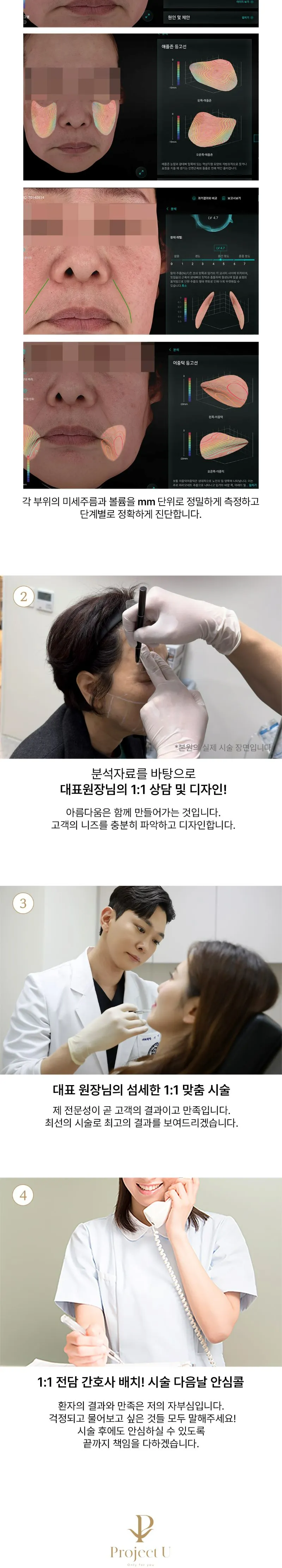 프로젝트유의원 💎필러카세💎대표원장 직접시술 이벤트, 시술 상세 이미지