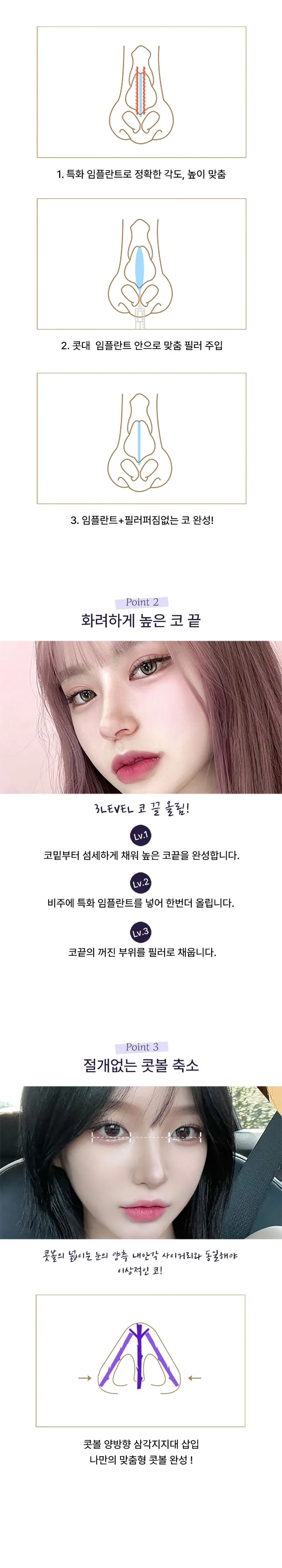 프로젝트유의원 💋시그니처_폼미코💄대표원장직접시술 이벤트, 시술 상세 이미지