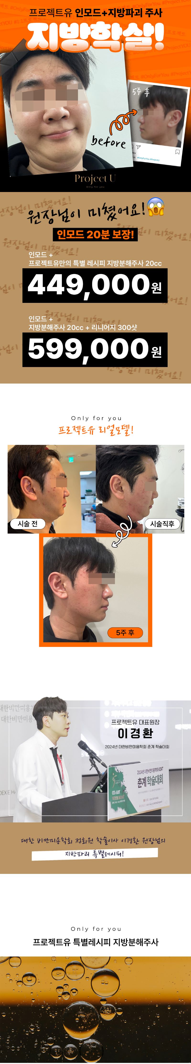 프로젝트유의원 🫠시그니처 지방파괴⏰시간보장⏰💉 이벤트, 시술 상세 이미지