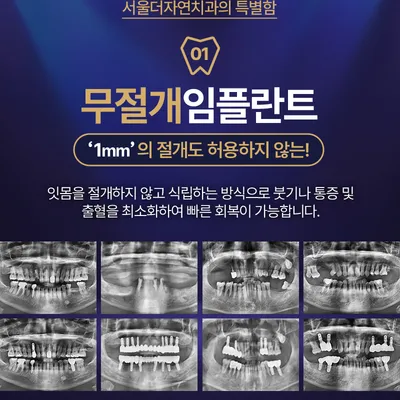 서울더자연치과 최소절개,빠른회복 서울더자연임플란트 이벤트, 시술 상세 이미지