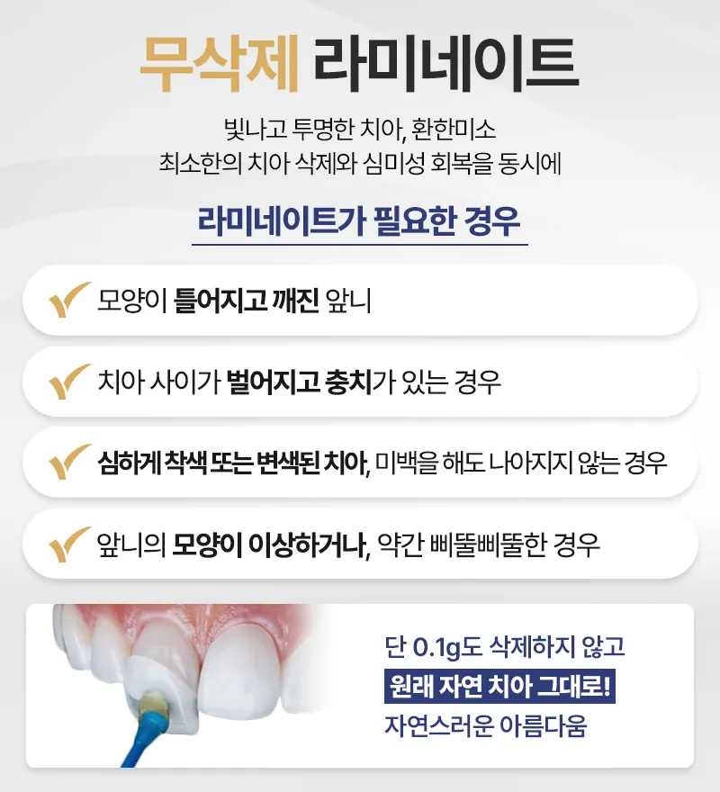 서울더자연치과 자연스러운 아름다움, 무삭제라미네이트 이벤트, 시술 상세 이미지