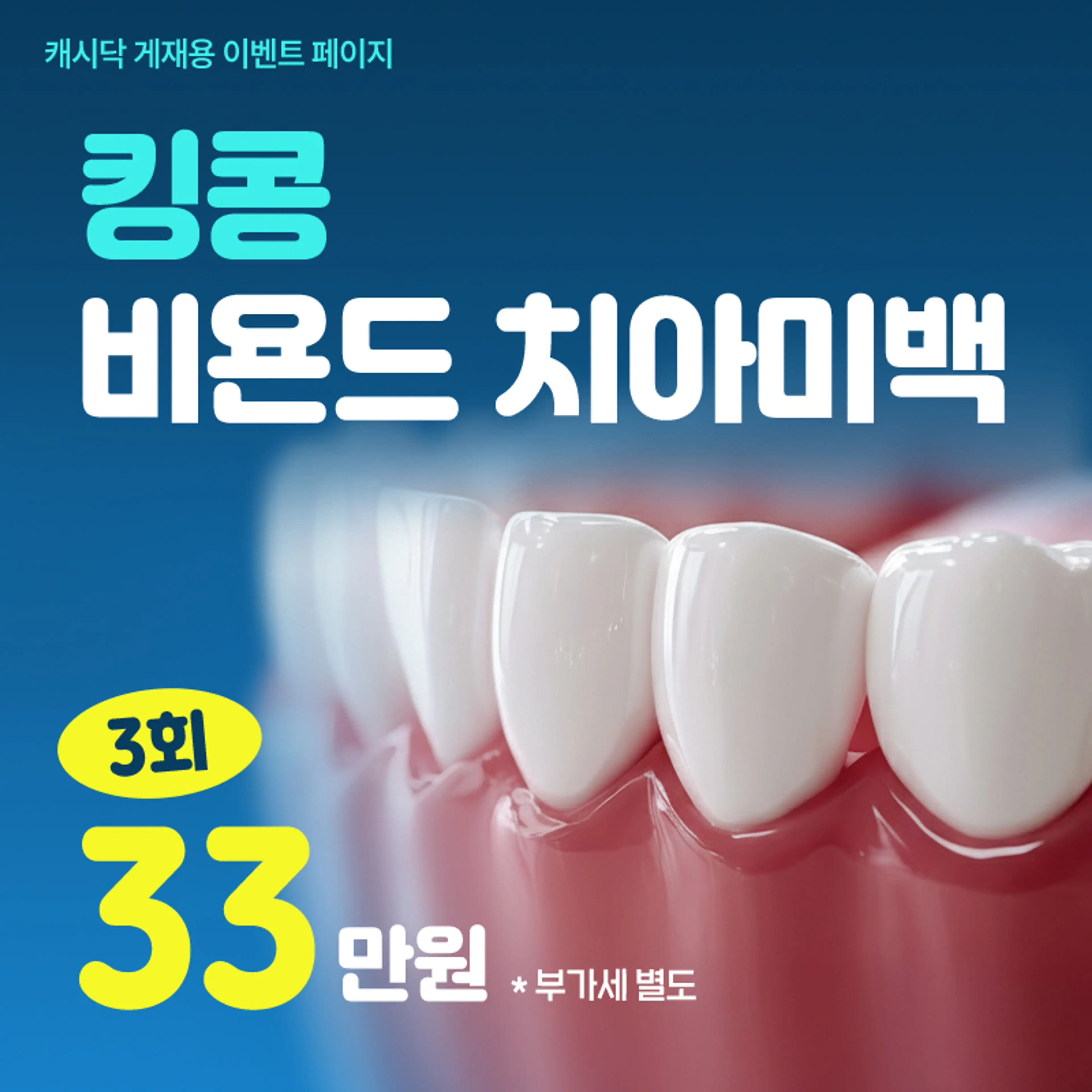 킹콩 비욘드 치아미백 3회 33만원