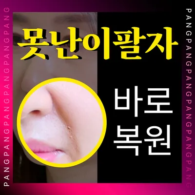 팔자주름 OUT✅팔자복원 실리프팅 이벤트 썸네일 이미지