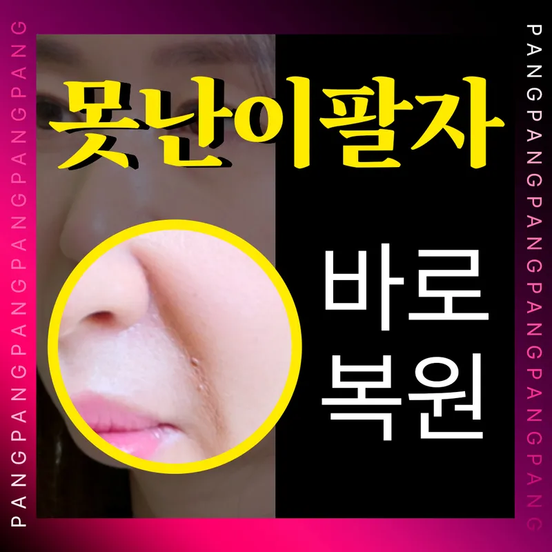 팔자주름 OUT✅팔자복원 실리프팅 이벤트 썸네일 이미지