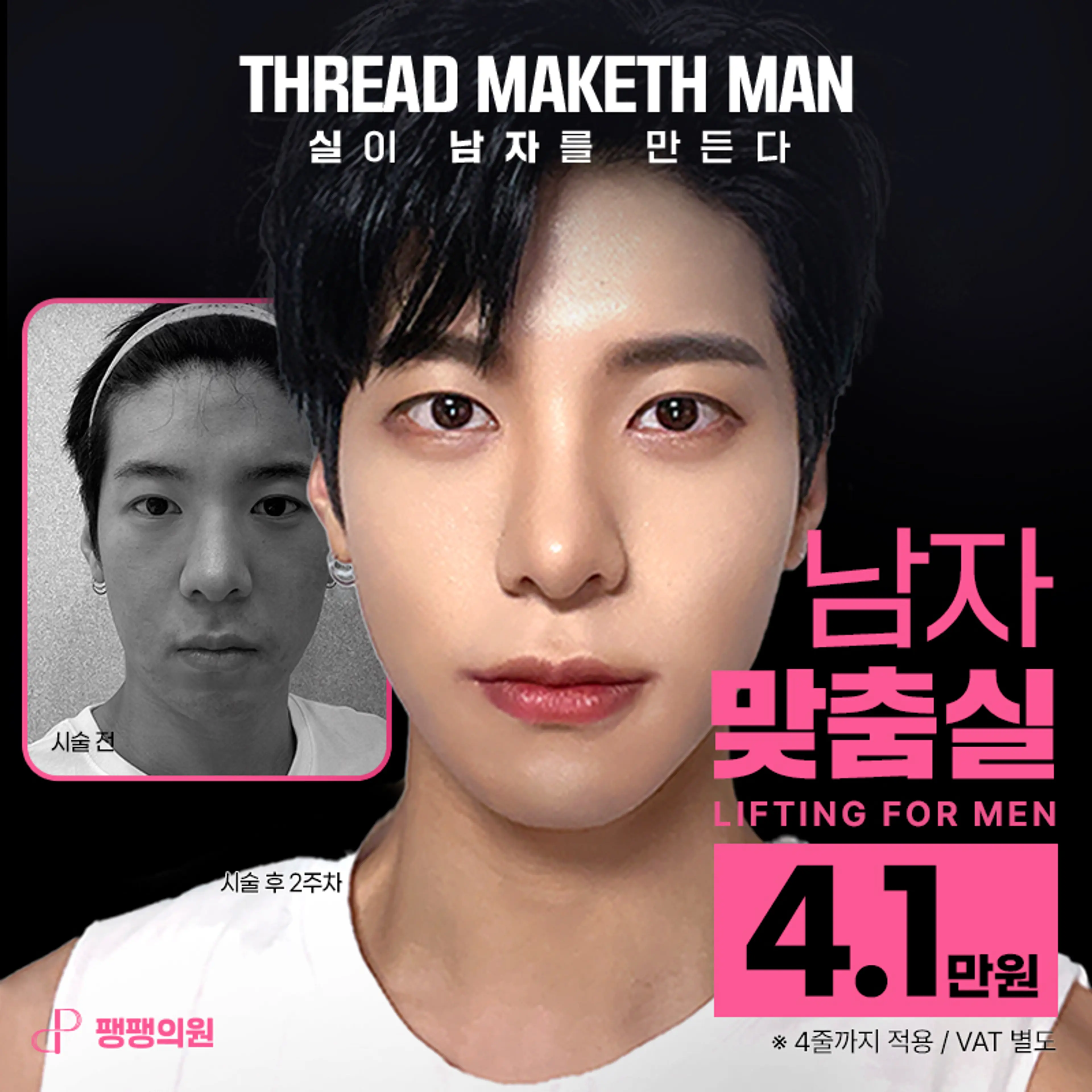 남자의 실리프팅, 남자의 완성은 실!