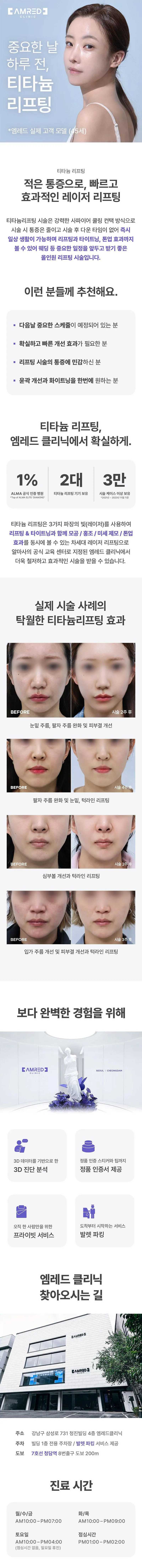 엠레드의원 비스포크 티타늄 리프팅 이벤트, 시술 상세 이미지