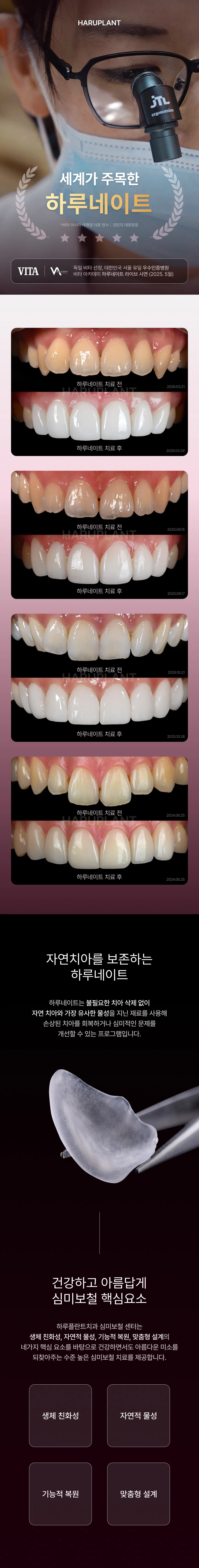 【 무삭제 라미네이트 39만원 】