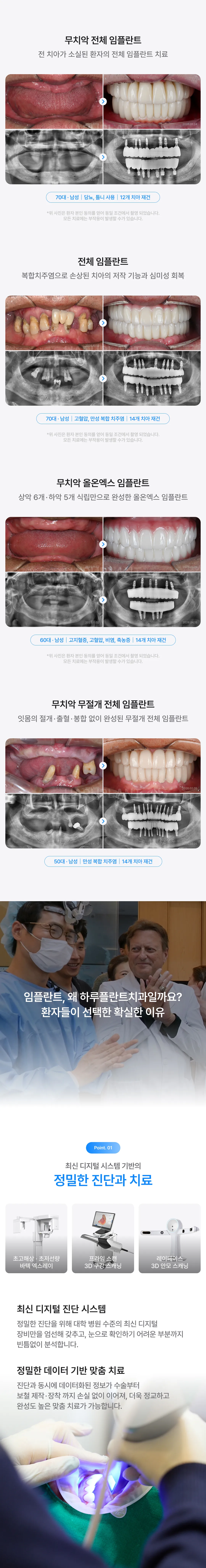 오스템 임플란트 18만원