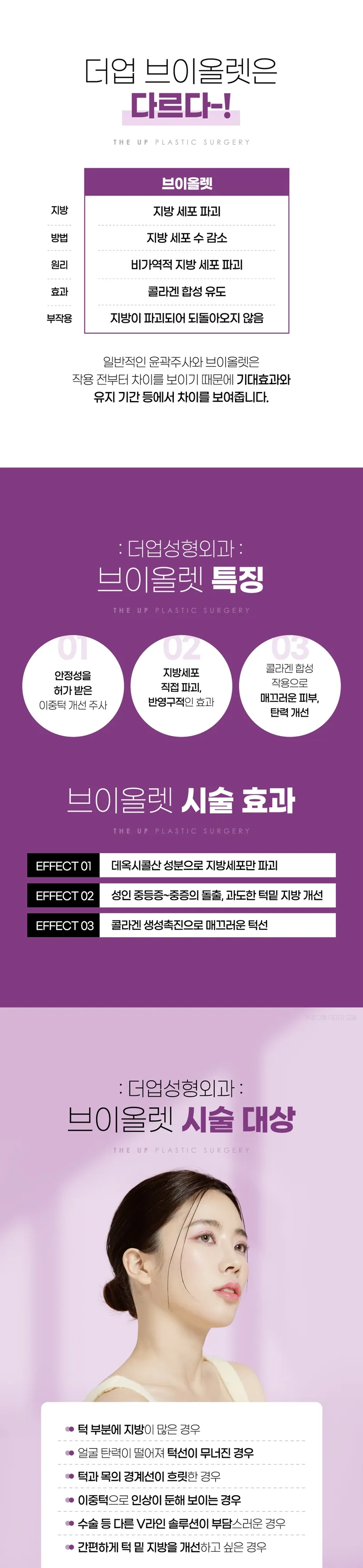 더업성형외과의원 이중턱 개선 브이올렛 주사 이벤트, 시술 상세 이미지