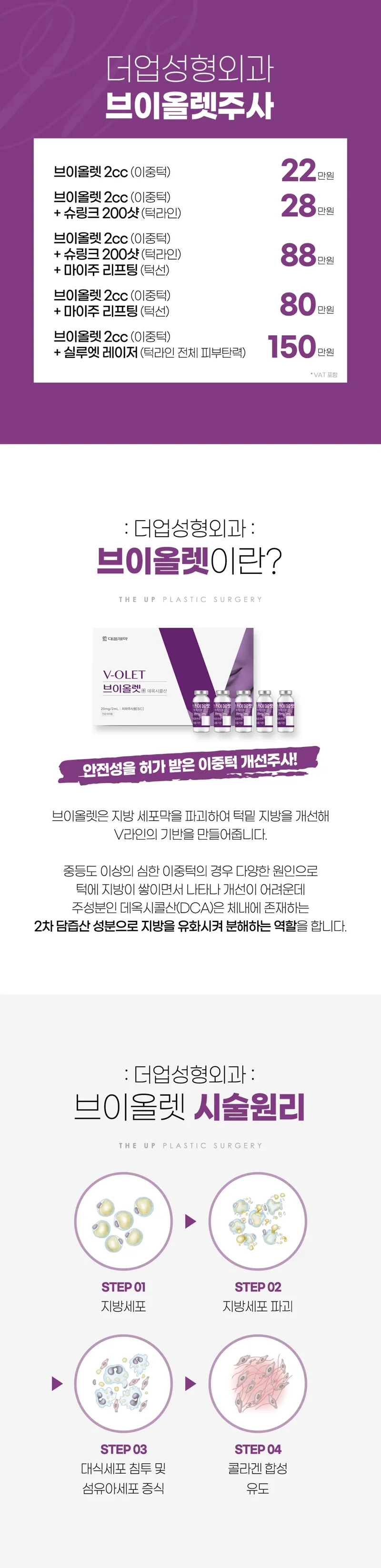 더업성형외과의원 이중턱 개선 브이올렛 주사 이벤트, 시술 상세 이미지