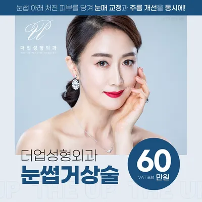 처진 눈매 UP! 눈썹거상술 이벤트 썸네일 이미지