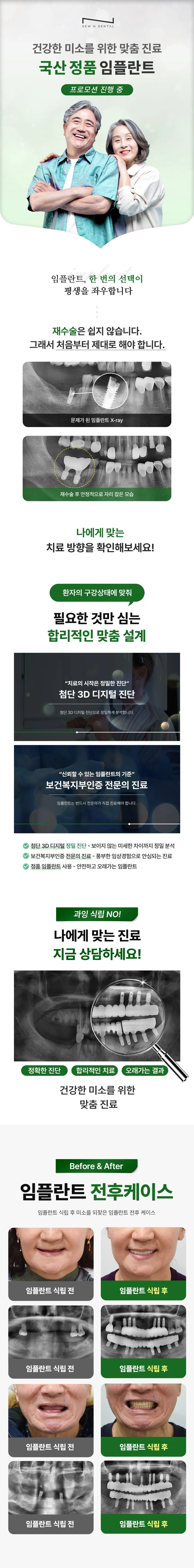 뉴엔치과의원 국산 정품 임플란트 29만원! 이벤트, 시술 상세 이미지