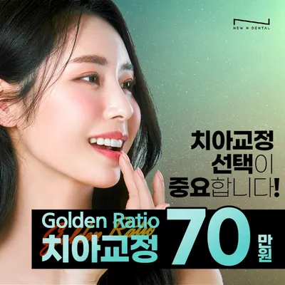 GoldenRatio 황금비율치아교정 이벤트 썸네일 이미지