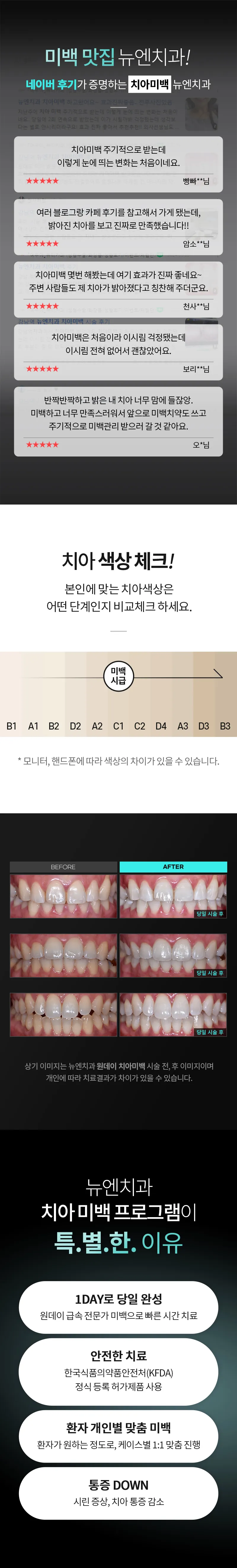 뉴엔치과의원 새하얀 미소, 미백맛집 뉴엔치과! 이벤트, 시술 상세 이미지