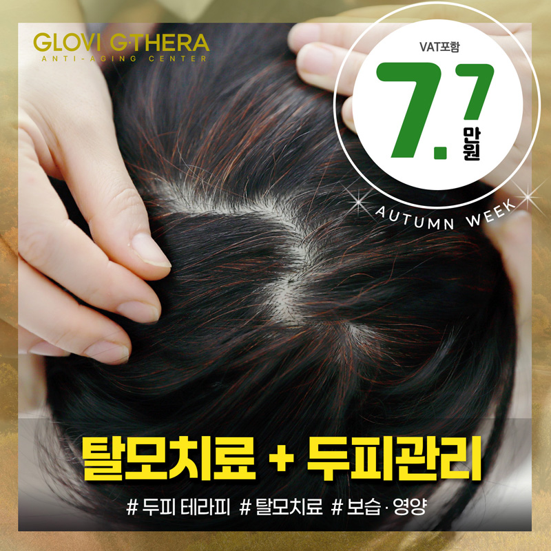 지테라 탈모치료 & 메디컬 두피관리 이벤트 썸네일 이미지