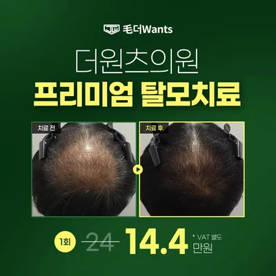 프리미엄 탈모치료♥ 이벤트 썸네일 이미지