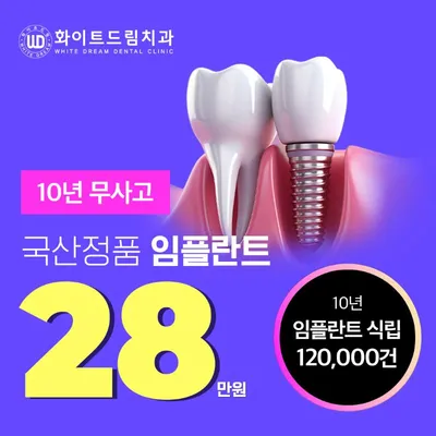 당일식립 합리적인 임플란트 28만원 이벤트 썸네일 이미지