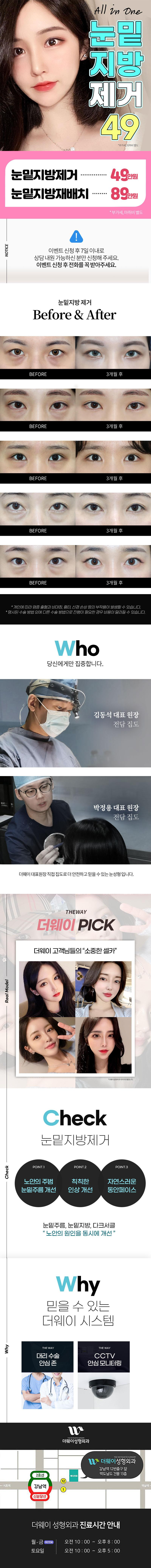 더웨이성형외과 🎀올인원 눈밑지방제거 이벤트, 시술 상세 이미지