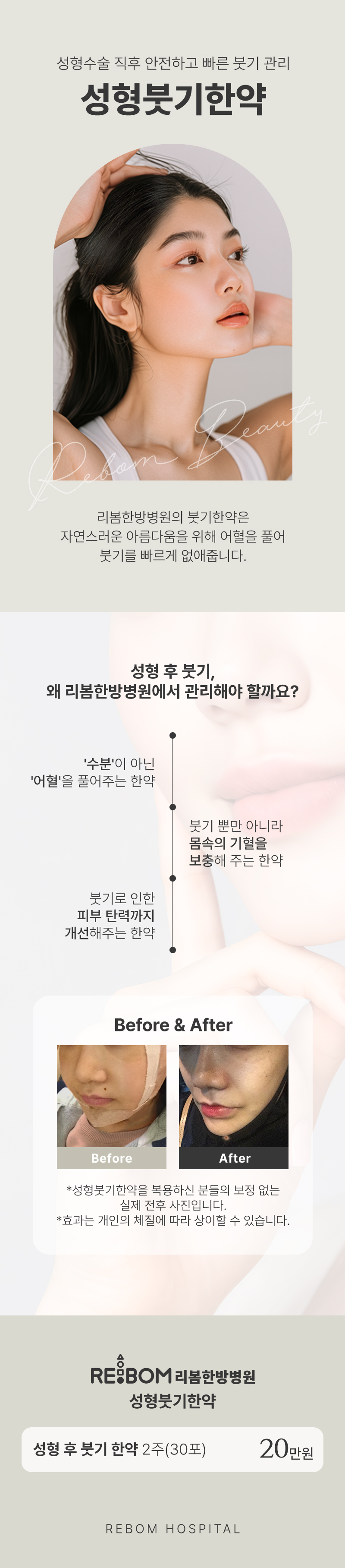 리봄한방병원 강남점 리봄 강남❤성형후붓기한약 2주❤ 이벤트, 시술 상세 이미지