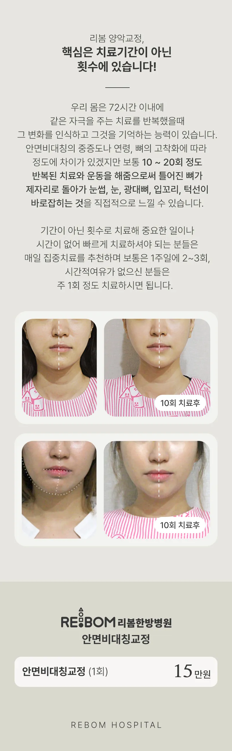 리봄한방병원 강남점 리봄 강남 ❤안면비대칭교정❤ 이벤트, 시술 상세 이미지