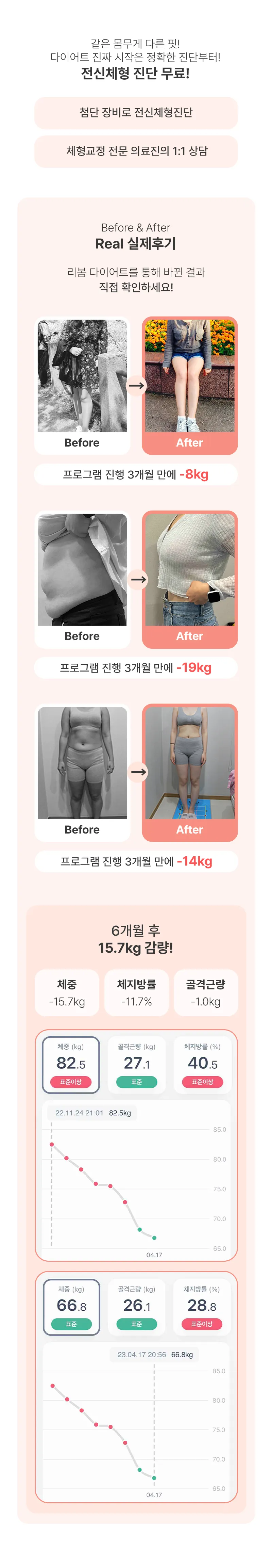 리봄한방병원 대구점 리봄 대구❤️지방박살패키지 1개월❤️ 이벤트, 시술 상세 이미지