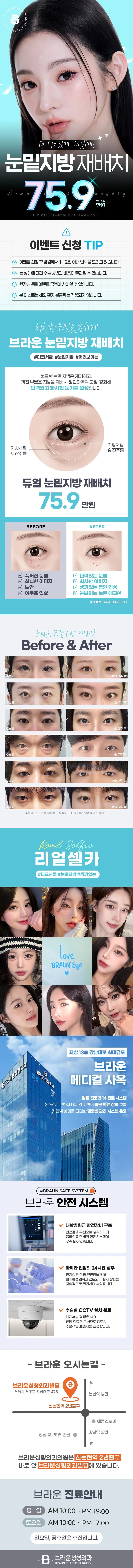 브라운성형외과의원 브라운 눈밑지방재배치 이벤트, 시술 상세 이미지
