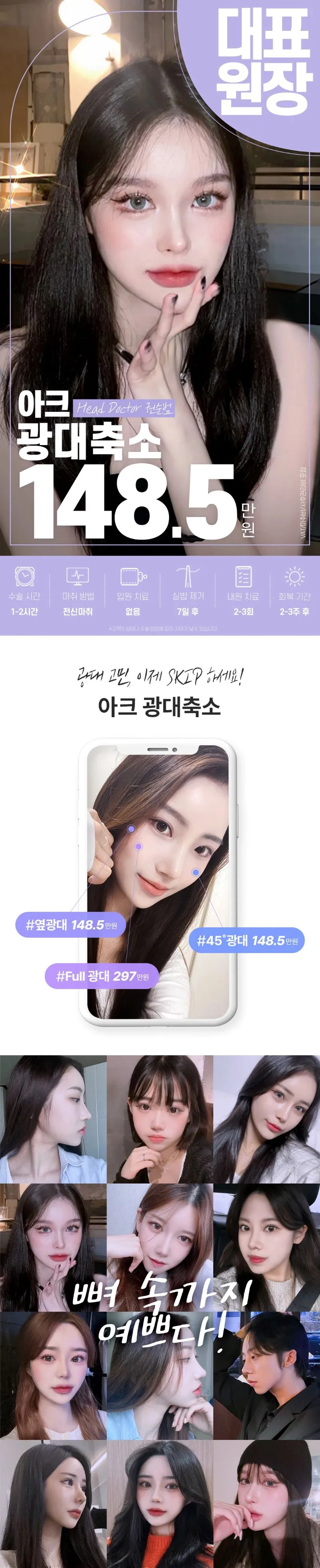 아크성형외과의원 아크_광대축소 이벤트, 시술 상세 이미지