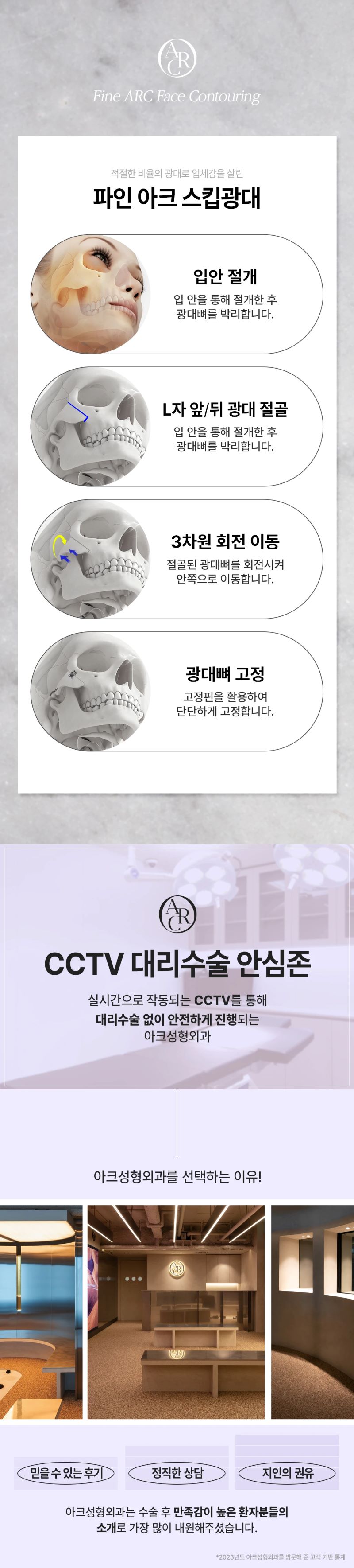 아크성형외과의원 아크_광대축소 이벤트, 시술 상세 이미지