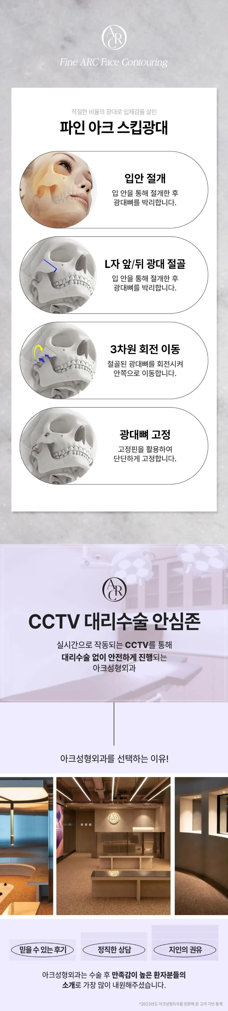 아크성형외과의원 아크_광대축소 이벤트, 시술 상세 이미지