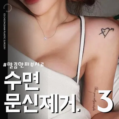 아프지마 수면문신제거 이벤트 썸네일 이미지