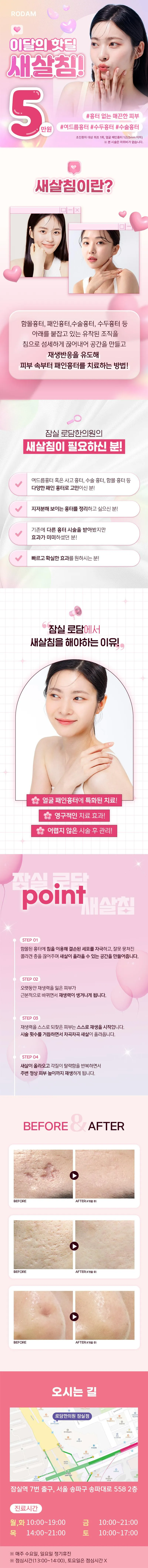 로담한의원 잠실점 잠들어 있는 흉터 피부 이벤트, 시술 상세 이미지