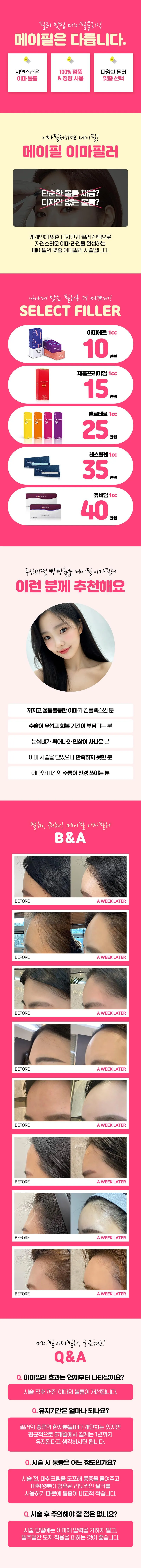 메이필의원 커스텀 이마필러 1cc당 이벤트, 시술 상세 이미지