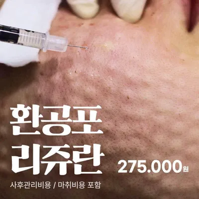 환공포리쥬란 2cc+피부진단+진정관리 이벤트 썸네일 이미지