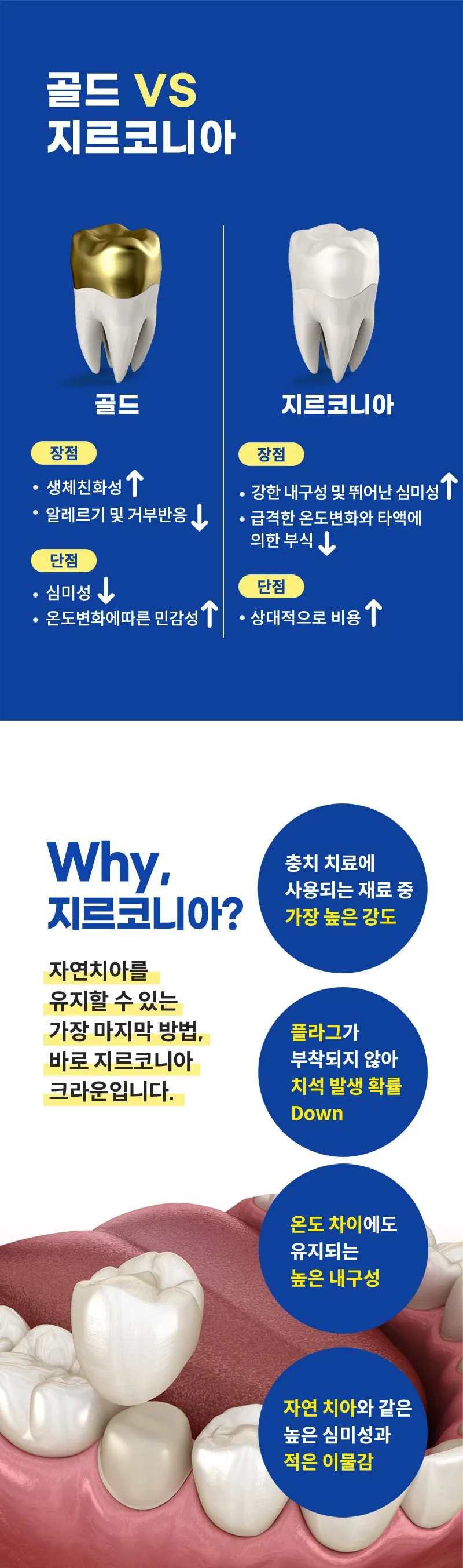 이수스마트치과의원 지르코니아 크라운 충치치료  이벤트, 시술 상세 이미지