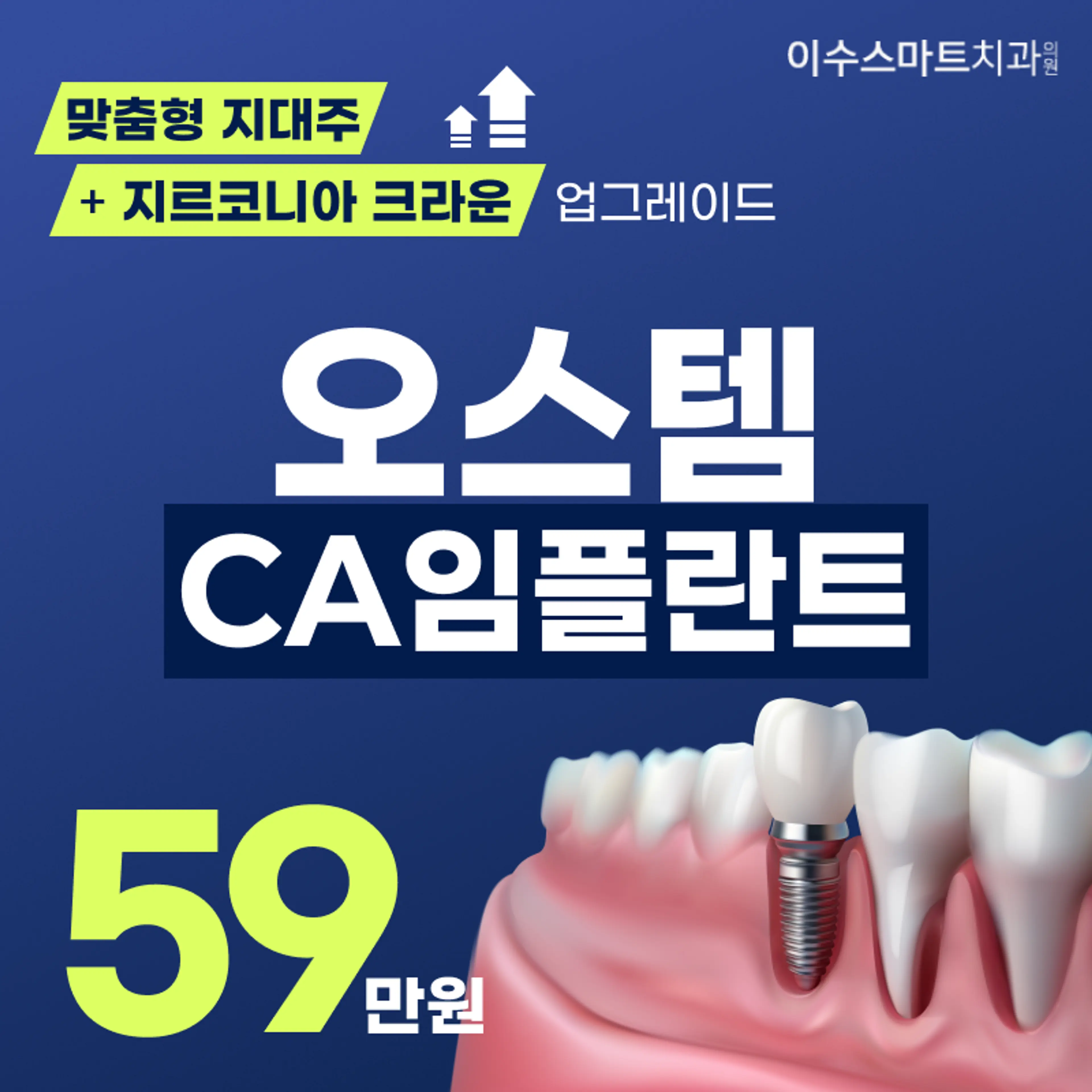 오스템 CA임플란트