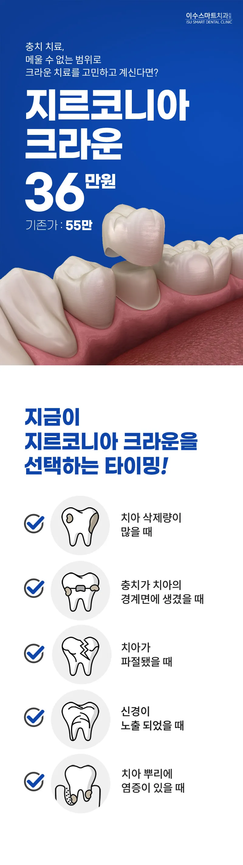 이수스마트치과의원 지르코니아 크라운 충치치료  이벤트, 시술 상세 이미지
