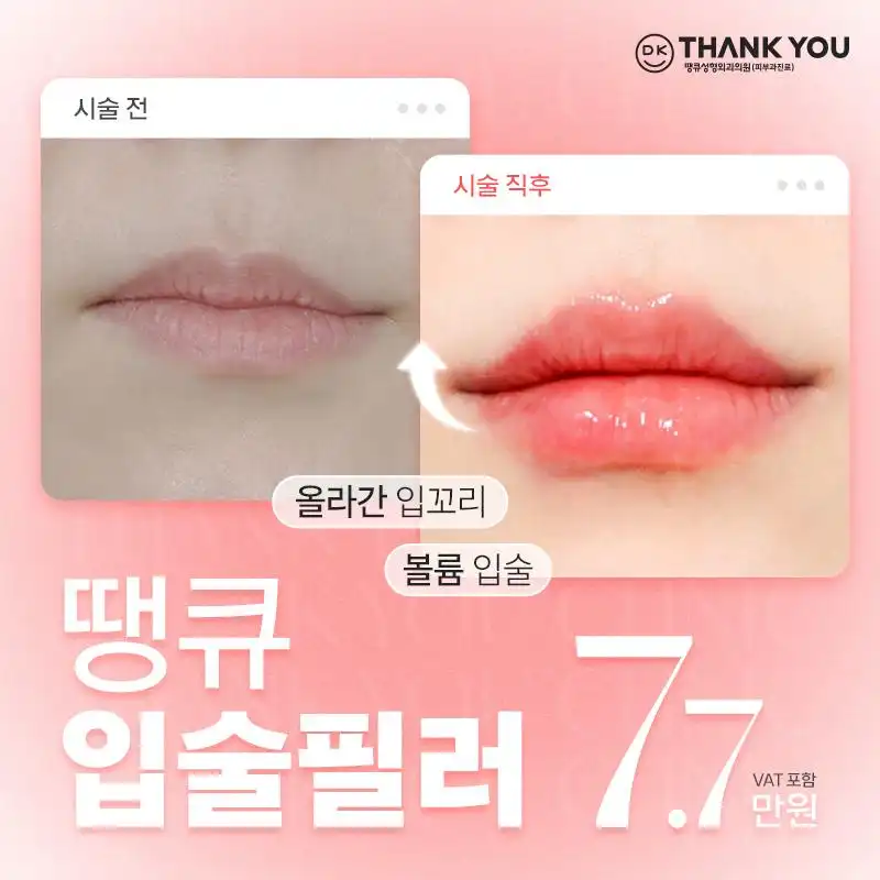 땡큐 입술,입꼬리 필러