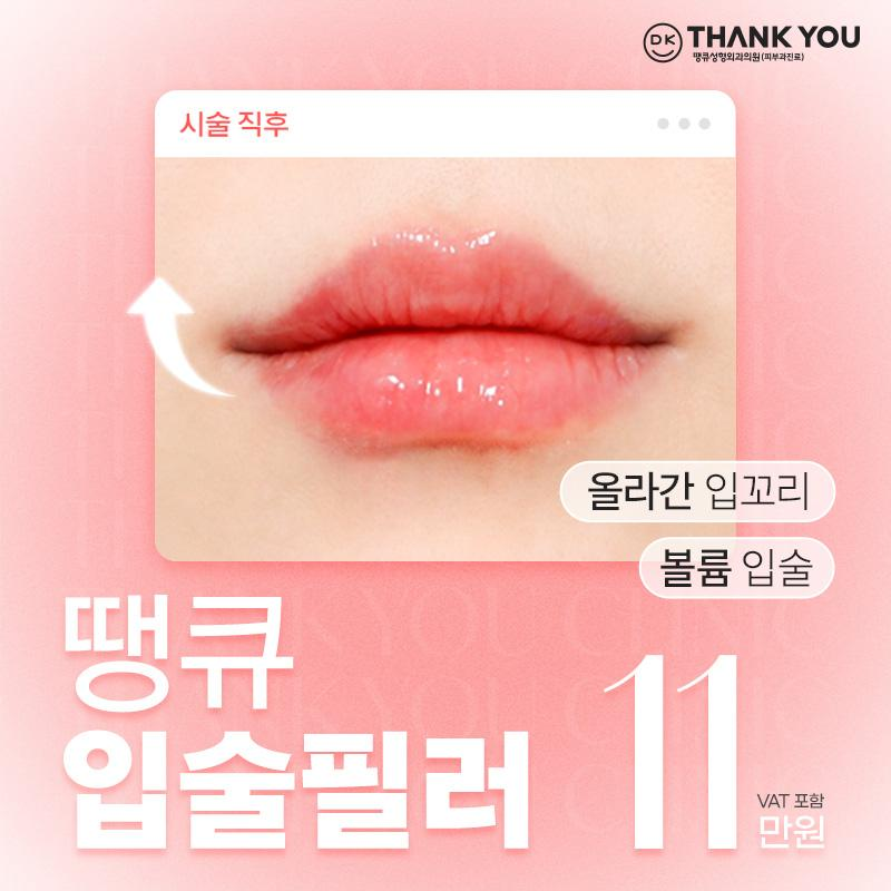 땡큐 입술필러 이벤트 썸네일 이미지