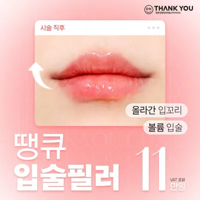 땡큐 입술필러 이벤트 썸네일 이미지
