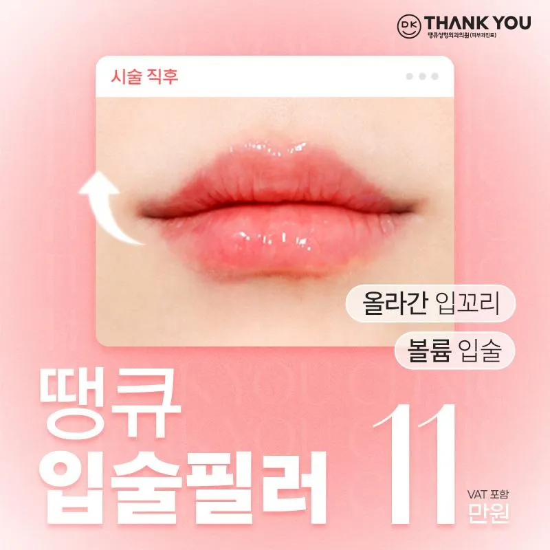 땡큐 입술필러 이벤트 썸네일 이미지