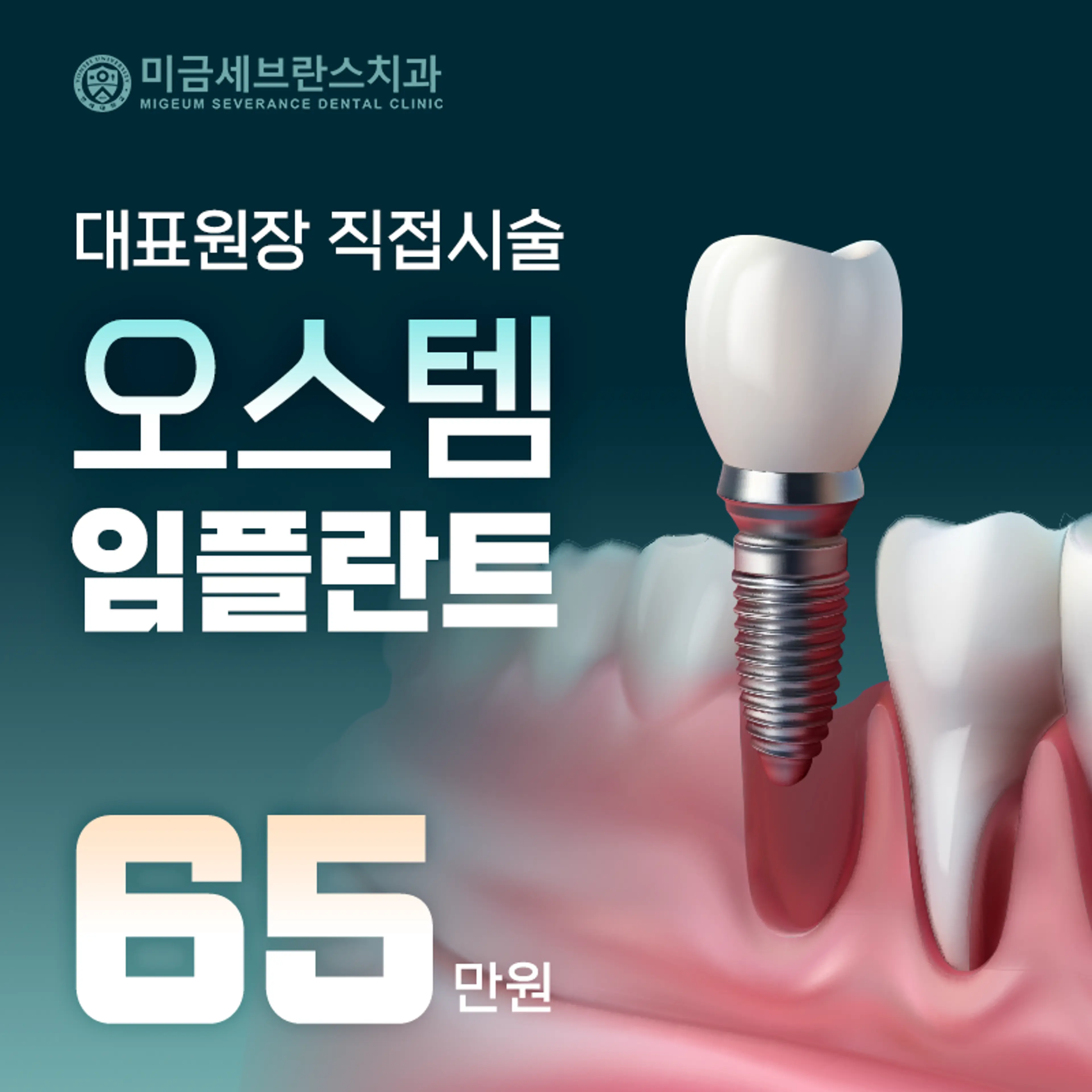 미금세브란스치과 오스템 임플란트