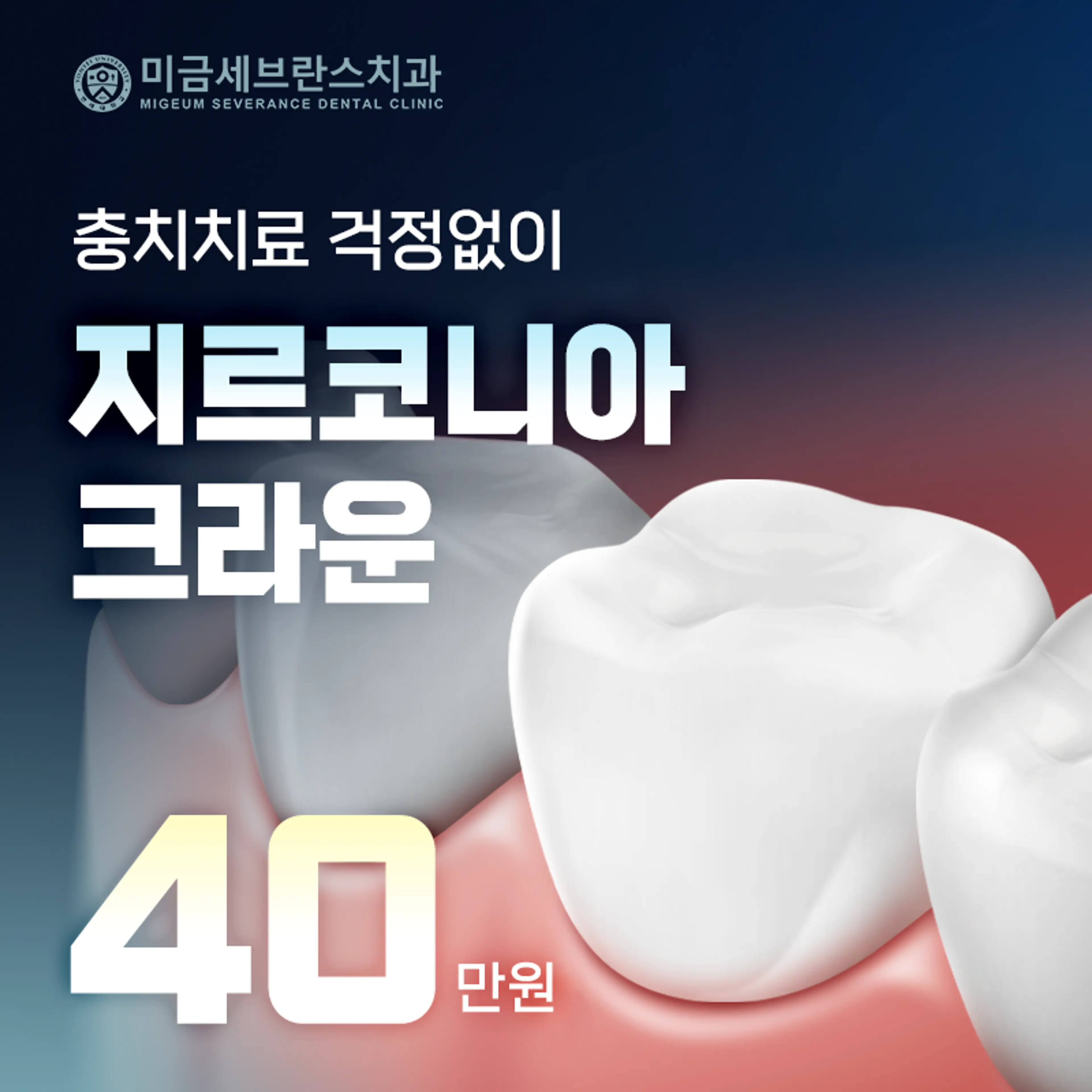 미금세브란스치과 지르코니아 크라운